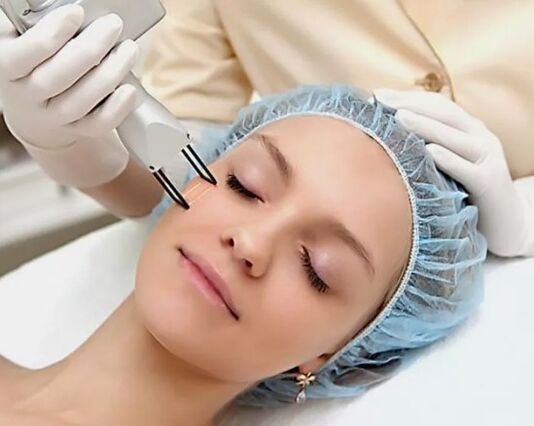 Laser rejuvenation field