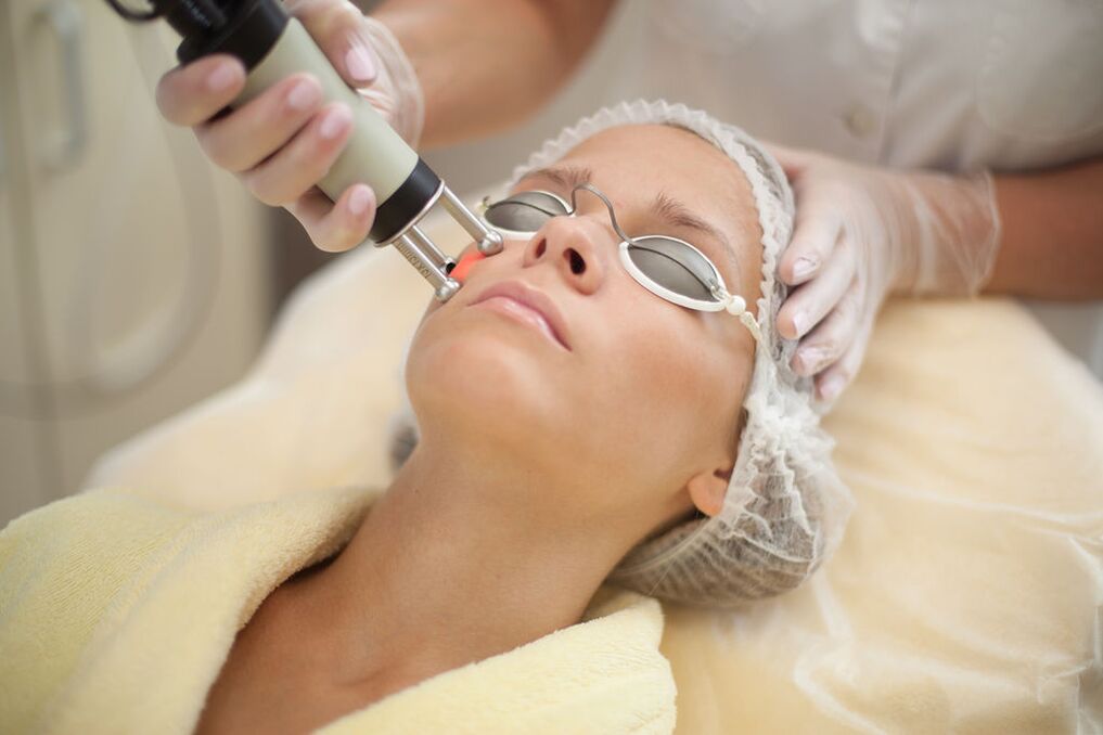 Laser skin rejuvenation