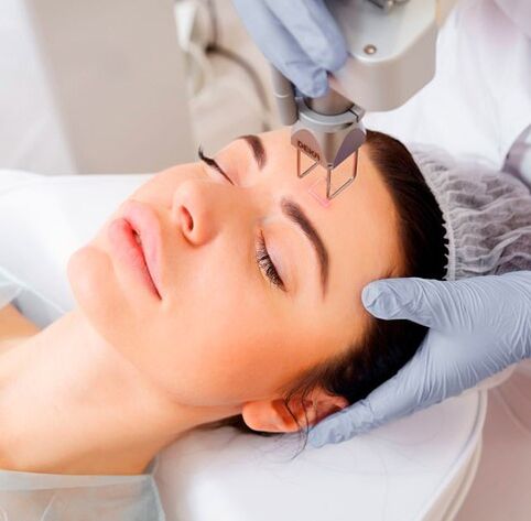Laser rejuvenation