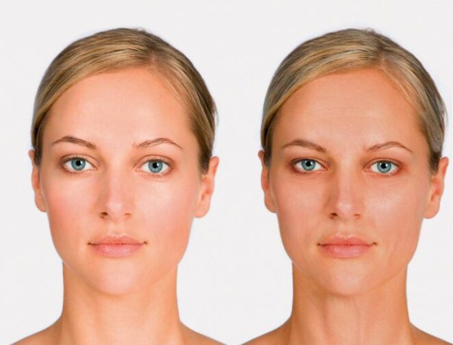 person after and before rejuvenation