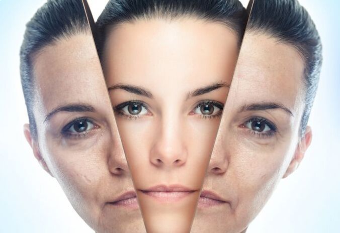 The process of removing the facial skin from age-related changes